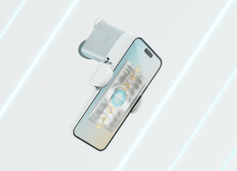 DentalMonitoring ScanBox device holding a smartphone.